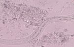 Угрица кишечная – внешний вид, цикл развития, условия обитания, стронгилоидоз